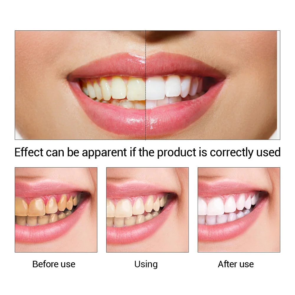 FTEENPLY ฟันไวท์เทนนิ่ง Oral ส - Teeth Whitening Clinic บทวิจารณ์และราคา