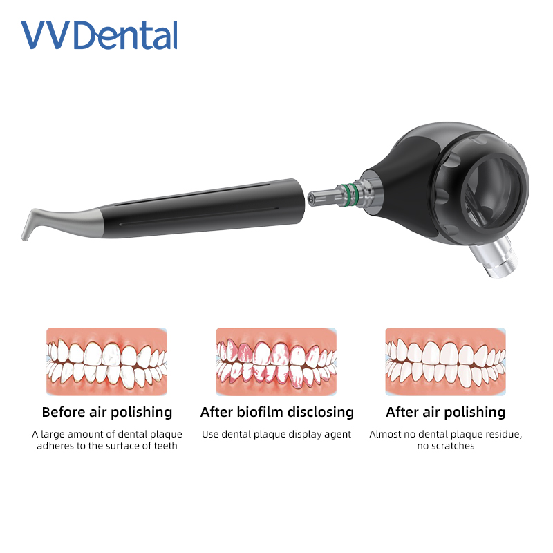 เครื่องพ่นลมขัดฟัน VVDental Ai - Colgate Whitening Teeth บทวิจารณ์และราคา